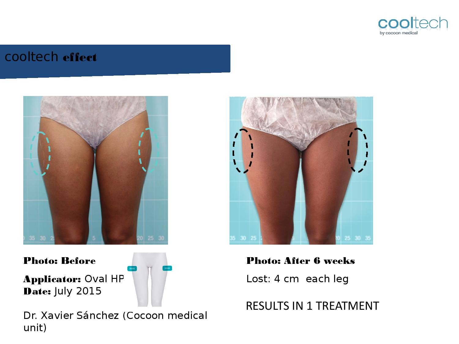 Presentation Cooltech ENG Wigmore Days Novaaaa1-page-007